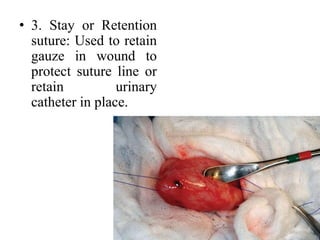 • 3. Stay or Retention
suture: Used to retain
gauze in wound to
protect suture line or
retain urinary
catheter in place.
 