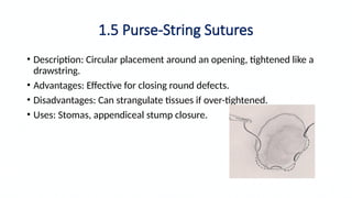 How To String Suture Comprehensive Guide to Sutures and Suturing Techniques in Surgery | PPTX