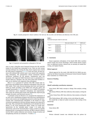 Suture Suspension Sling Arthroplasty for Thumb CMC Joint Arthritis ...
