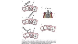 Suture Guide.pdf Suture techniques.pdf