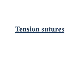 Tension sutures
 