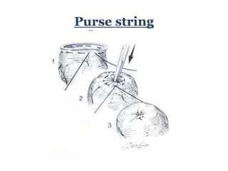 How To String Suture Suture training course | PPTX