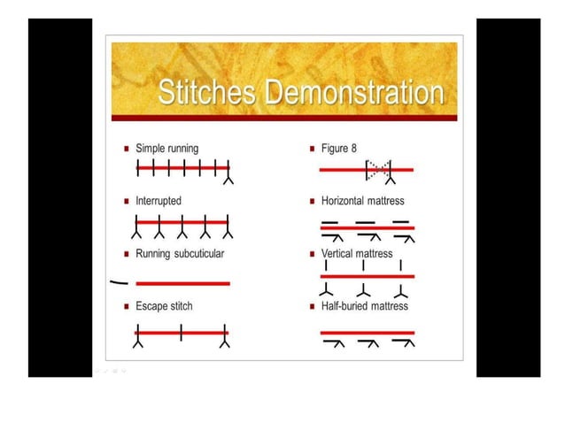 Suturing | PPTX | First Aid | Injuries
