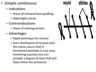 • Simple continuous
– Indications
• Areas of intraoral bone grafting
• Watertight suture
– Contraindications
• Areas of existing tension
– Advantages
• Rapid technique for closure
• Even distribution of tension over
the entire suture line( if
hematoma develops in one area,
remaining sutured area can
provide a degree of slack that will
help relieve the pressure)
 