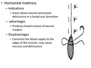 • Horizontal mattress
– Indications
• Areas where wound contraction
dehiscence or a broad scar formation
– advantages
• Produces broad contact of wound
margins
– Disadvantages
• Constricts the blood supply to the
edges of the incision, may cause
necrosis and dehiscence
 