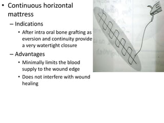 • Continuous horizontal
mattress
– Indications
• After intra oral bone grafting as
eversion and continuity provide
a very watertight closure
– Advantages
• Minimally limits the blood
supply to the wound edge
• Does not interfere with wound
healing
 