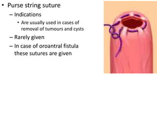 • Purse string suture
– Indications
• Are usually used in cases of
removal of tumours and cysts
– Rarely given
– In case of oroantral fistula
these sutures are given
 