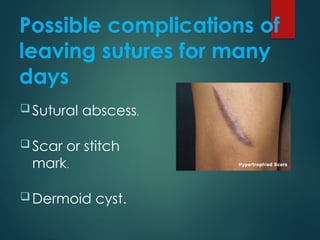Medical surgical and pathophysiology and wound suturing | PPTX