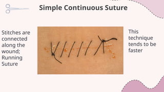 Suturing -- The Basic Surgical Tying Techniques found in the OR | PPTX
