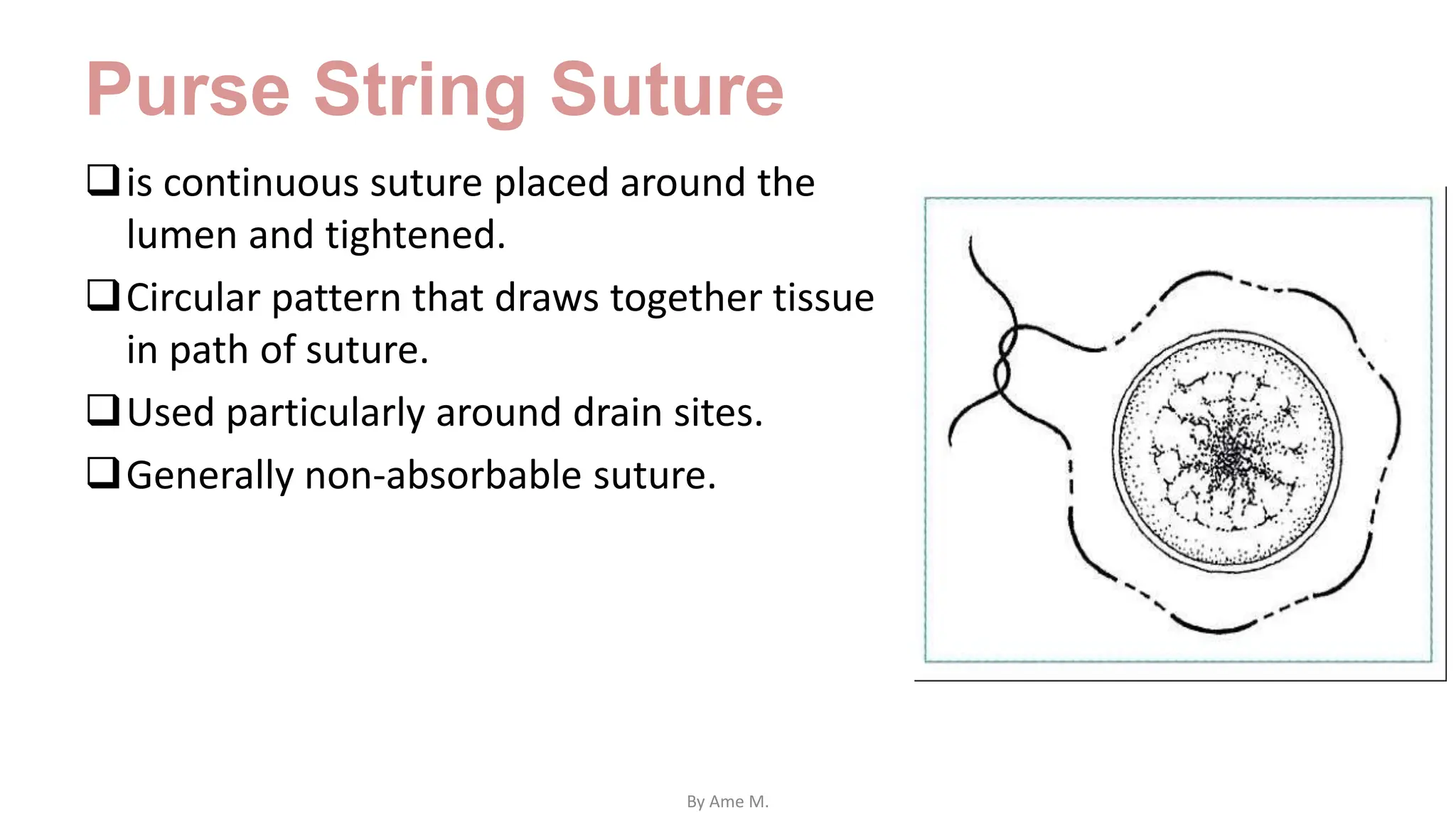 Purse String Suture
is continuous suture placed around the
lumen and tightened.
Circular pattern that draws together tissue
in path of suture.
Used particularly around drain sites.
Generally non-absorbable suture.
By Ame M.
 