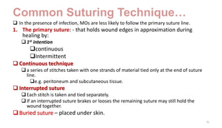 Common Suturing Technique…
 In the presence of infection, MOs are less likely to follow the primary suture line.
1. The primary suture: - that holds wound edges in approximation during
healing by:
1st intention
continuous
Intermittent
 Continuous technique
a series of stitches taken with one strands of material tied only at the end of suture
line.
e.g. peritoneum and subcutaneous tissue.
 Interrupted suture
Each stitch is taken and tied separately.
If an interrupted suture brakes or looses the remaining suture may still hold the
wound together.
Buried suture – placed under skin.
31
 