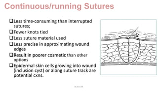 Continuous/running Sutures
Less time-consuming than interrupted
sutures;
Fewer knots tied
Less suture material used
Less precise in approximating wound
edges
Result in poorer cosmetic than other
options
Epidermal skin cells growing into wound
(inclusion cyst) or along suture track are
potential cxns.
By Ame M.
 