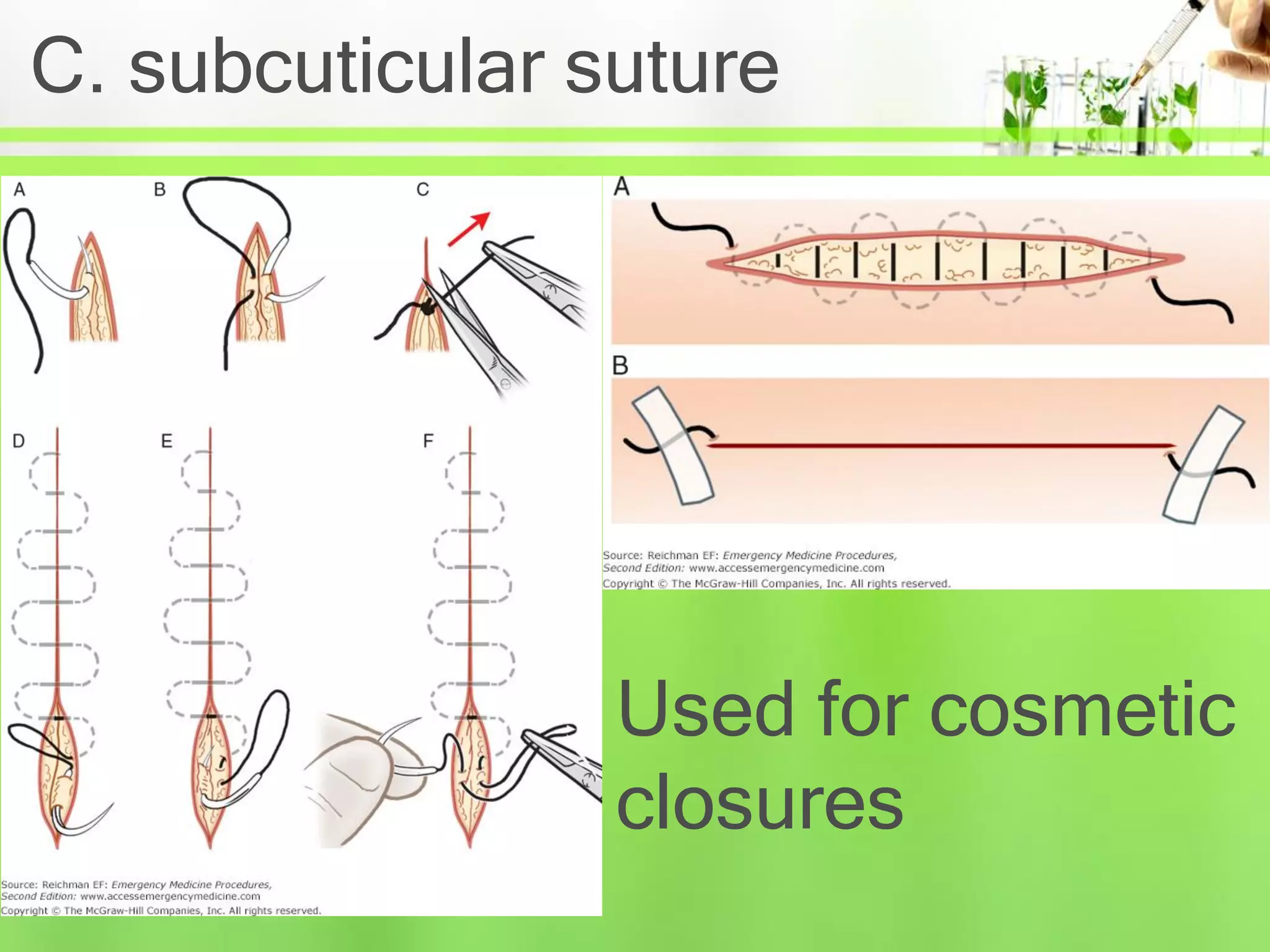 Suturing Dr Bijendra Shah Ppt PDF