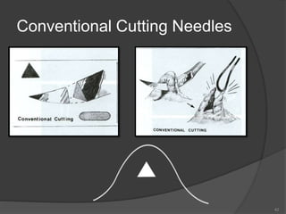 Conventional Cutting Needles
42
 