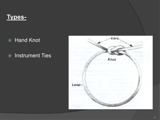 Types-
 Hand Knot
 Instrument Ties
56
 