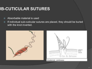 UB-CUTICULAR SUTURES
 Absorbable material is used
 If individual sub-cuticular sutures are placed, they should be buried
with the knot inverted.
70
 