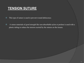 TENSION SUTURE
 This type of suture is used to prevent wound dehiscence.
 A suture materials of good strength like non-absorbable nylon or prolene is used with a
plastic tubing to reduce the tension exerted by the sutures on the tissues.
72
 