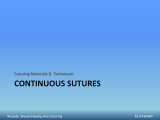 Suturing Materials & Techniques

    CONTINUOUS SUTURES


Wounds, Wound Healing And Suturing    ELHAWARY
 