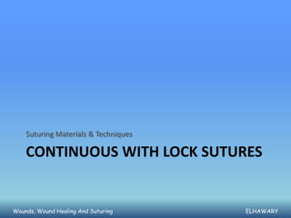 Suturing Materials & Techniques

    CONTINUOUS WITH LOCK SUTURES


Wounds, Wound Healing And Suturing    ELHAWARY
 