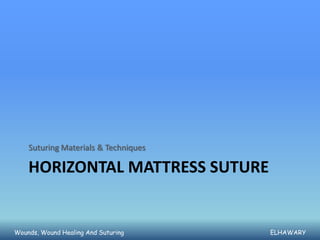 Suturing Materials & Techniques

    HORIZONTAL MATTRESS SUTURE


Wounds, Wound Healing And Suturing    ELHAWARY
 