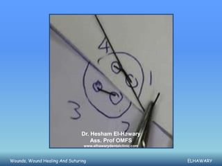 Dr. Hesham El-Hawary
                                    Ass. Prof OMFS
                                 www.elhawarydentalclinic.com



Wounds, Wound Healing And Suturing                              ELHAWARY
 