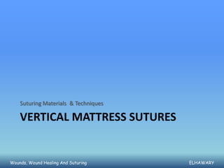 Suturing Materials & Techniques

    VERTICAL MATTRESS SUTURES


Wounds, Wound Healing And Suturing    ELHAWARY
 