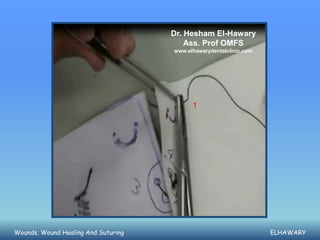 Dr. Hesham El-Hawary
                                         Ass. Prof OMFS
                                     www.elhawarydentalclinic.com




                                           1




Wounds, Wound Healing And Suturing                                  ELHAWARY
 
