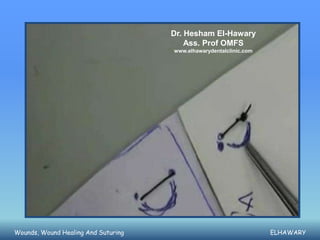 Dr. Hesham El-Hawary
                                         Ass. Prof OMFS
                                     www.elhawarydentalclinic.com




Wounds, Wound Healing And Suturing                                  ELHAWARY
 