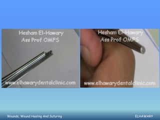 Wounds, Wound Healing And Suturing   ELHAWARY
 
