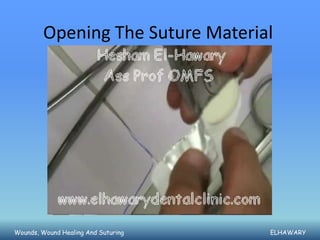 Opening The Suture Material




Wounds, Wound Healing And Suturing   ELHAWARY
 