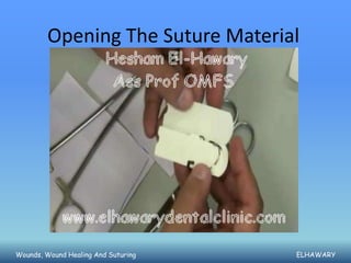 Opening The Suture Material




Wounds, Wound Healing And Suturing   ELHAWARY
 