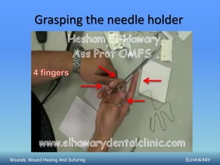 Grasping the needle holder




Wounds, Wound Healing And Suturing      ELHAWARY
 