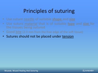 Principles of suturing
• Use suture needle of suitable shape and size
• Use suture material that is of suitable type and size for
  the tissues being sutured
• Good bite (2:3 mm from the free edge of the soft tissue)
• Sutures should not be placed under tension




 Wounds, Wound Healing And Suturing                ELHAWARY
 