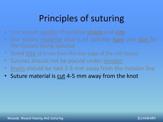 Principles of suturing
• Use suture needle of suitable shape and size
• Use suture material that is of suitable type and size for
  the tissues being sutured
• Good bite (2:3 mm from the free edge of the soft tissue)
• Sutures should not be placed under tension
• Knots should be tied 2-3 mm away from the incision line
• Suture material is cut 4-5 mm away from the knot




 Wounds, Wound Healing And Suturing                ELHAWARY
 
