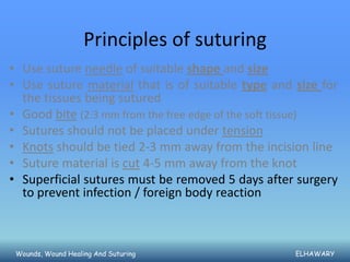 Principles of suturing
• Use suture needle of suitable shape and size
• Use suture material that is of suitable type and size for
  the tissues being sutured
• Good bite (2:3 mm from the free edge of the soft tissue)
• Sutures should not be placed under tension
• Knots should be tied 2-3 mm away from the incision line
• Suture material is cut 4-5 mm away from the knot
• Superficial sutures must be removed 5 days after surgery
  to prevent infection / foreign body reaction



 Wounds, Wound Healing And Suturing                ELHAWARY
 