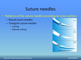 Suture needles
• Patterns of the suture needle according to cross section:
    – Round suture needles
    – Triangular suture needles
         • Cutting
         • Reverse cutting




                                            http://www.starmedix.com




 Wounds, Wound Healing And Suturing                           ELHAWARY
 