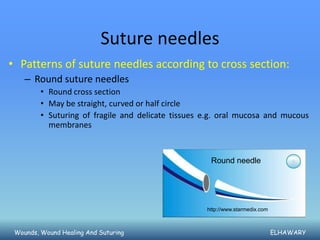 Suture needles
• Patterns of suture needles according to cross section:
    – Round suture needles
         • Round cross section
         • May be straight, curved or half circle
         • Suturing of fragile and delicate tissues e.g. oral mucosa and mucous
           membranes


                                                     Round needle




                                                    http://www.starmedix.com



 Wounds, Wound Healing And Suturing                                            ELHAWARY
 