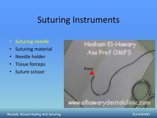 Suturing Instruments

 •   Suturing needle
 •   Suturing material
 •   Needle holder
 •   Tissue forceps
                                     Point
 •   Suture scissor




Wounds, Wound Healing And Suturing           ELHAWARY
 