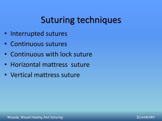 Suturing techniques
•    Interrupted sutures
•    Continuous sutures
•    Continuous with lock suture
•    Horizontal mattress suture
•    Vertical mattress suture




    Wounds, Wound Healing And Suturing        ELHAWARY
 