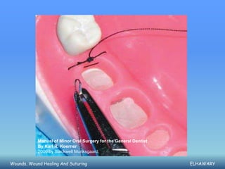 Manual of Minor Oral Surgery for the General Dentist
            By Karl R. Koerner
            2006 by Blackwell Munksgaard,

Wounds, Wound Healing And Suturing                                 ELHAWARY
 