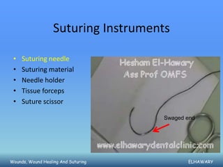 Suturing Instruments

 •   Suturing needle
 •   Suturing material
 •   Needle holder
 •   Tissue forceps
 •   Suture scissor

                                     Swaged end




Wounds, Wound Healing And Suturing          ELHAWARY
 