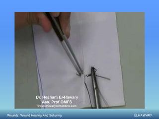 Dr. Hesham El-Hawary
                     Ass. Prof OMFS
                  www.elhawarydentalclinic.com


Wounds, Wound Healing And Suturing               ELHAWARY
 