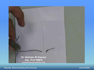 Dr. Hesham El-Hawary
                     Ass. Prof OMFS
                  www.elhawarydentalclinic.com


Wounds, Wound Healing And Suturing               ELHAWARY
 