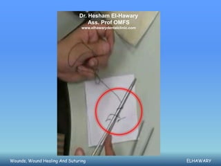 Dr. Hesham El-Hawary
                                   Ass. Prof OMFS
                                www.elhawarydentalclinic.com




Wounds, Wound Healing And Suturing                             ELHAWARY
 