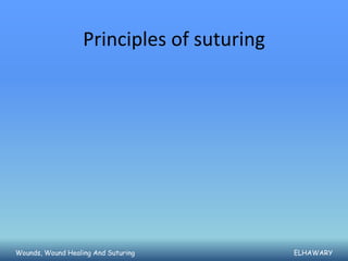 Principles of suturing




Wounds, Wound Healing And Suturing          ELHAWARY
 