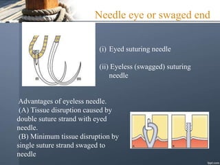 Needle eye or swaged end
(i) Eyed suturing needle
(ii) Eyeless (swagged) suturing
needle
Advantages of eyeless needle.
(A) Tissue disruption caused by
double suture strand with eyed
needle.
(B) Minimum tissue disruption by
single suture strand swaged to
needle
 