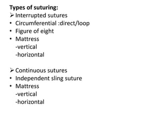 Types of suturing:
Interrupted sutures
• Circumferential :direct/loop
• Figure of eight
• Mattress
-vertical
-horizontal
Continuous sutures
• Independent sling suture
• Mattress
-vertical
-horizontal
 