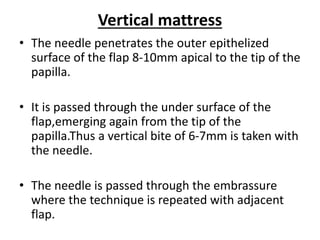 Vertical mattress
• The needle penetrates the outer epithelized
surface of the flap 8-10mm apical to the tip of the
papilla.
• It is passed through the under surface of the
flap,emerging again from the tip of the
papilla.Thus a vertical bite of 6-7mm is taken with
the needle.
• The needle is passed through the embrassure
where the technique is repeated with adjacent
flap.
 