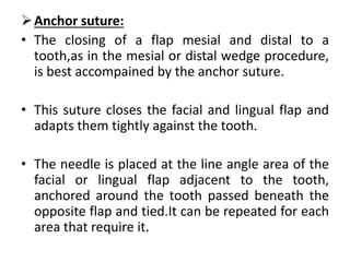 Anchor suture:
• The closing of a flap mesial and distal to a
tooth,as in the mesial or distal wedge procedure,
is best accompained by the anchor suture.
• This suture closes the facial and lingual flap and
adapts them tightly against the tooth.
• The needle is placed at the line angle area of the
facial or lingual flap adjacent to the tooth,
anchored around the tooth passed beneath the
opposite flap and tied.It can be repeated for each
area that require it.
 