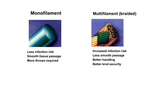 Less infection risk
Smooth tissue passage
More throws required
Monofilament
Increased infection risk
Less smooth passage
Better handling
Better knot security
Multifilament (braided)
 